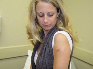 Jayme Otto patched up